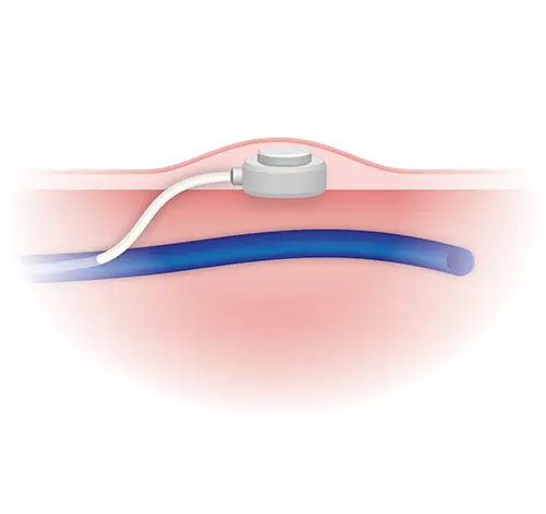 Dessin système mis en place dessin buste ganglion illustration Le Confluent